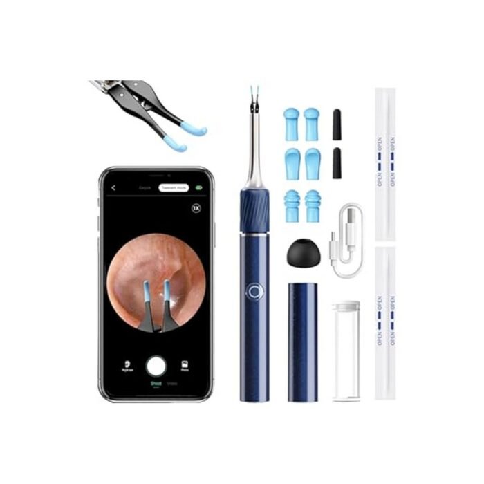 Ear injury from blind cleaning – Qimic HD Otoscope,