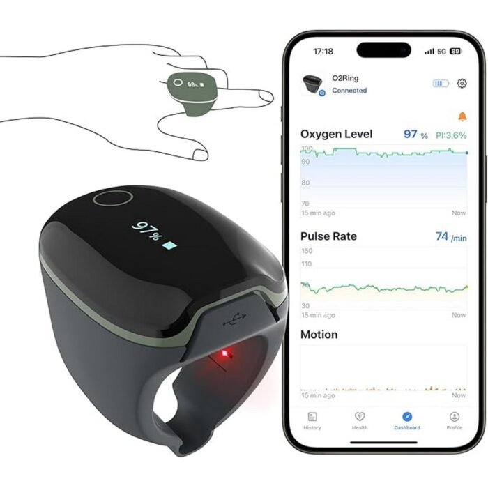 Отсутствие непрерывного мониторинга SpO₂ и пульса во время сна - ViATOM, O2ring Bluetooth пульсоксиметр, Дискомфорт от громоздких или пальцевых зажимов пульсоксиметров ночью - ViATOM, O2ring Bluetooth пульсоксиметр, Нет предупреждений в реальном времени о критическом снижении насыщения кислородом - ViATOM, O2ring Bluetooth пульсоксиметр, Трудности с отслеживанием долгосрочных тенденций без интеграции с приложением - ViATOM, O2ring Bluetooth пульсоксиметр